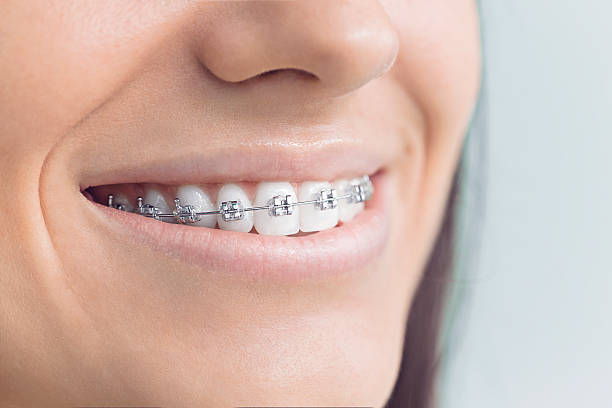 Best Veneers and Lumineers  in Ferndale, MD